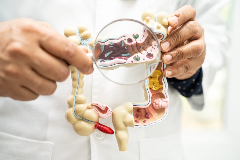 Why Gut Health is More Than Just Digestion (And Why I Care Now More Than Ever) intestine, appendix and digestive system, doctor holding anatomy